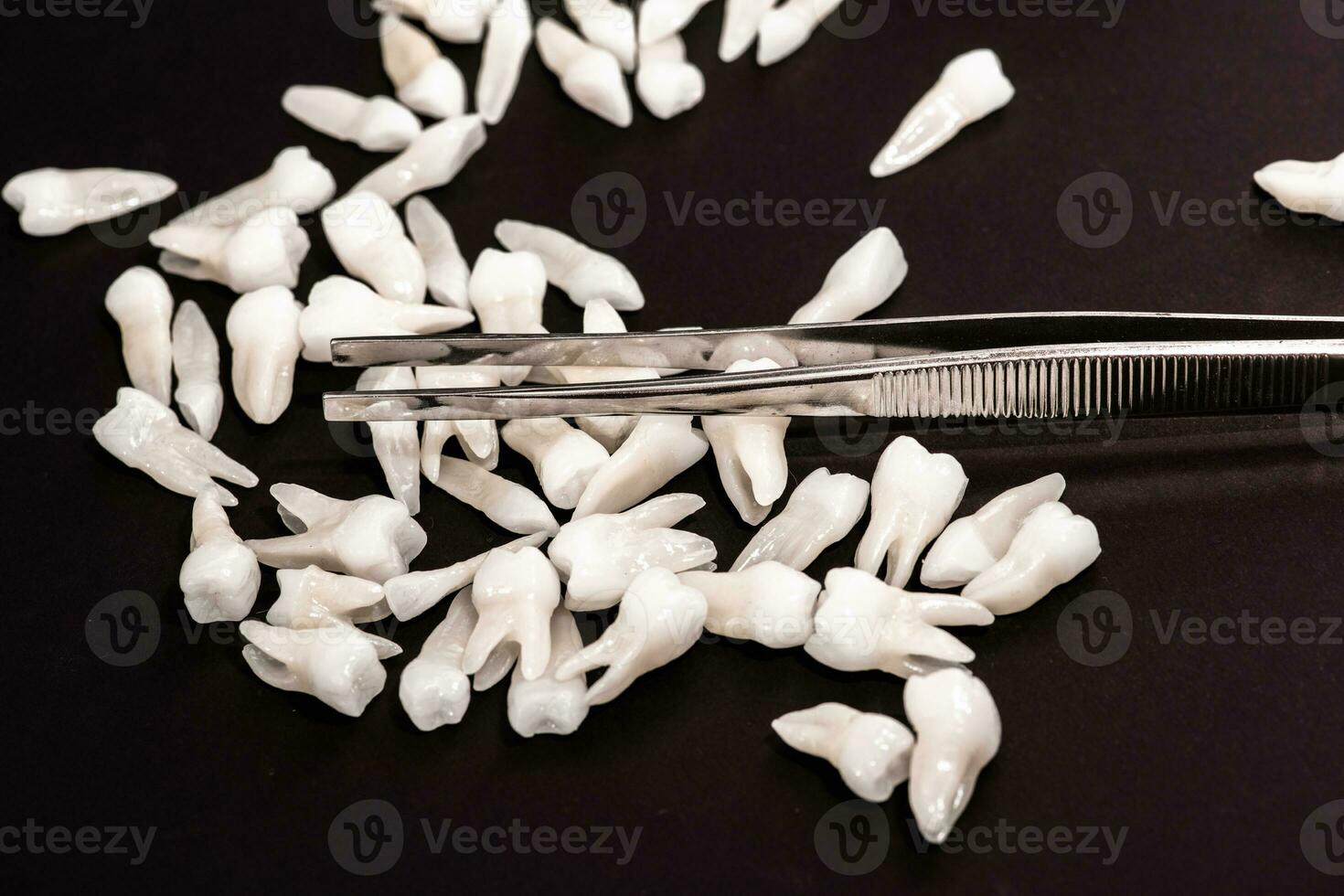 Teeth implant and crown installation process parts isolated on a black background. Medically accurate 3D model. photo