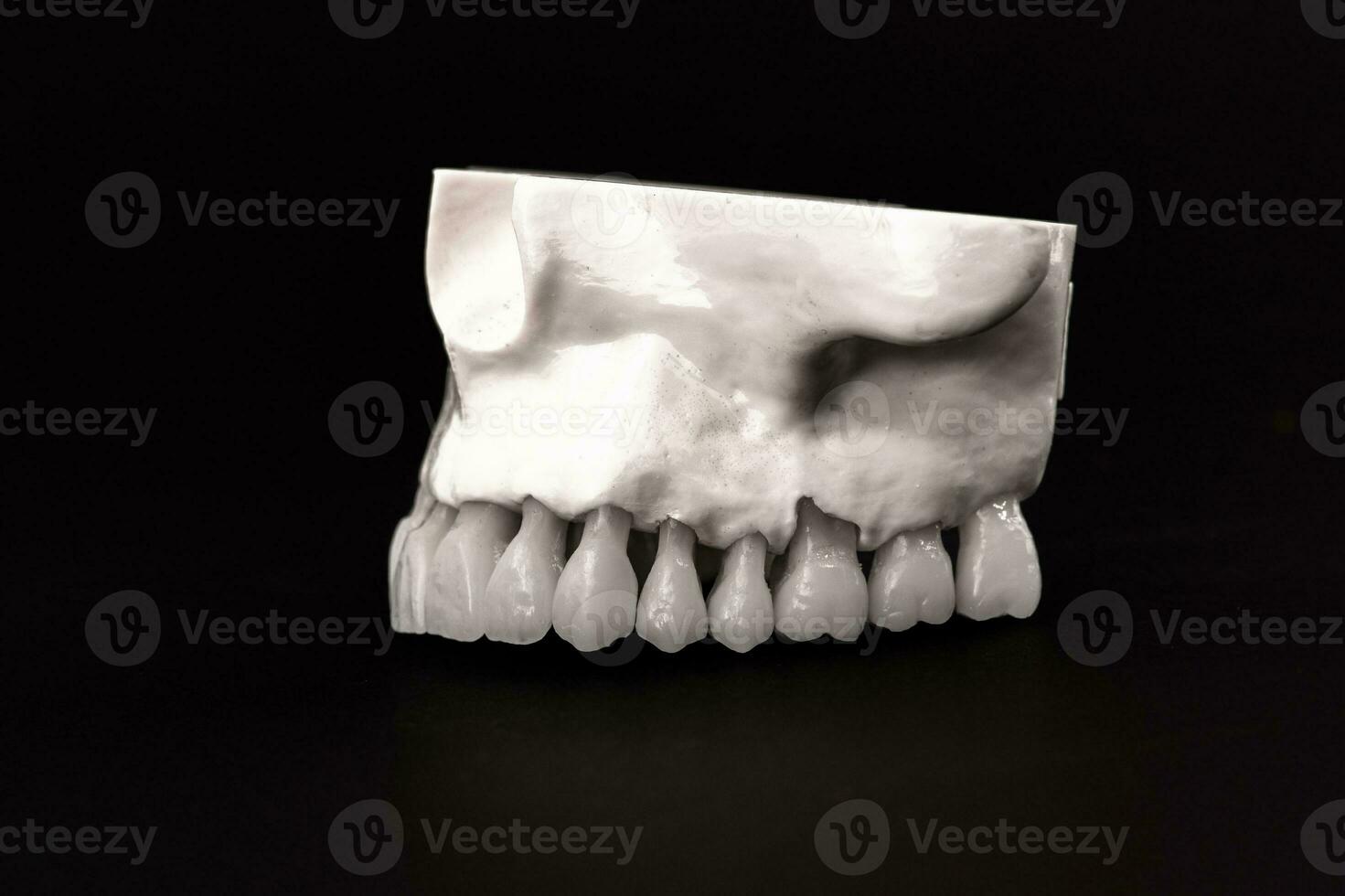 Lower human jaw with teeth anatomy model isolated on black background. Healthy teeth, dental care and orthodontic medical concept. photo