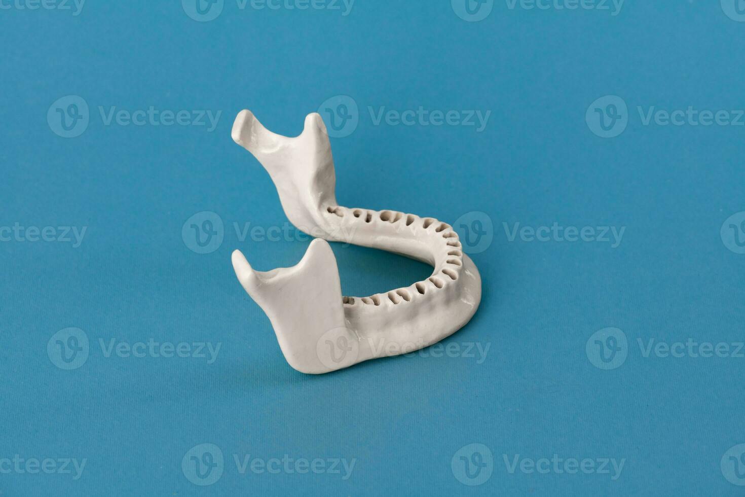 Upper human jaw without teeth model medical implant isolated on blue background. Healthy teeth, dental care and orthodontic concept. photo