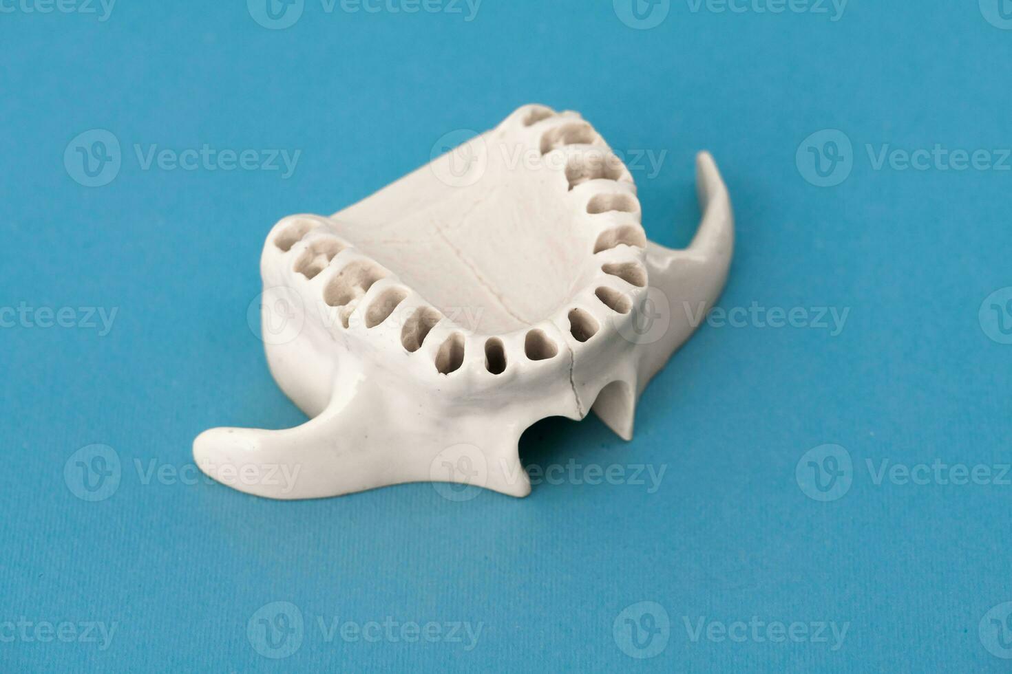 Upper human jaw without teeth model medical implant isolated on blue background. Healthy teeth, dental care and orthodontic concept. photo