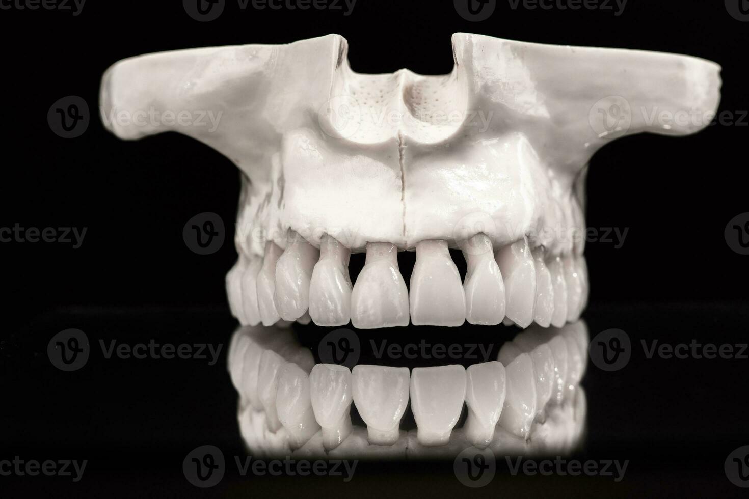 Upper human jaw with a reflection on the glass anatomy model solated on blue background. Healthy teeth, dental care and orthodontic medical concept. photo