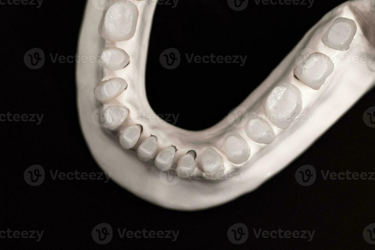 Lower human jaw with teeth anatomy model isolated on black background. Healthy teeth, dental care and orthodontic medical healthcare concept. photo