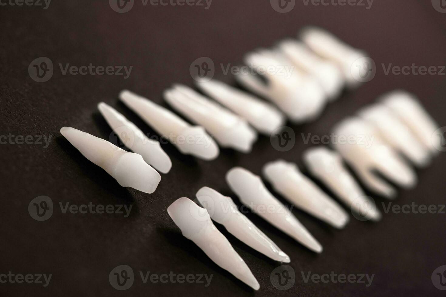 Prosthetic dentistry White teeth on black background Oral dental hygiene Dental health concept Oral care teeth restoration top view. photo