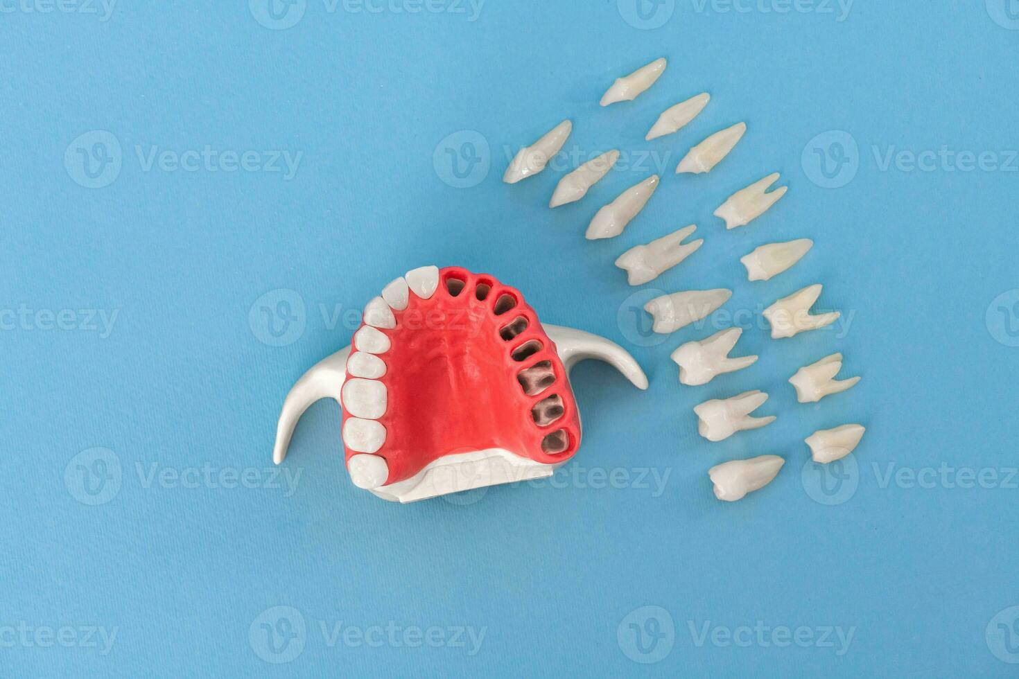 dientes implante y corona instalación proceso partes aislado en un azul antecedentes. médicamente preciso 3d modelo. foto