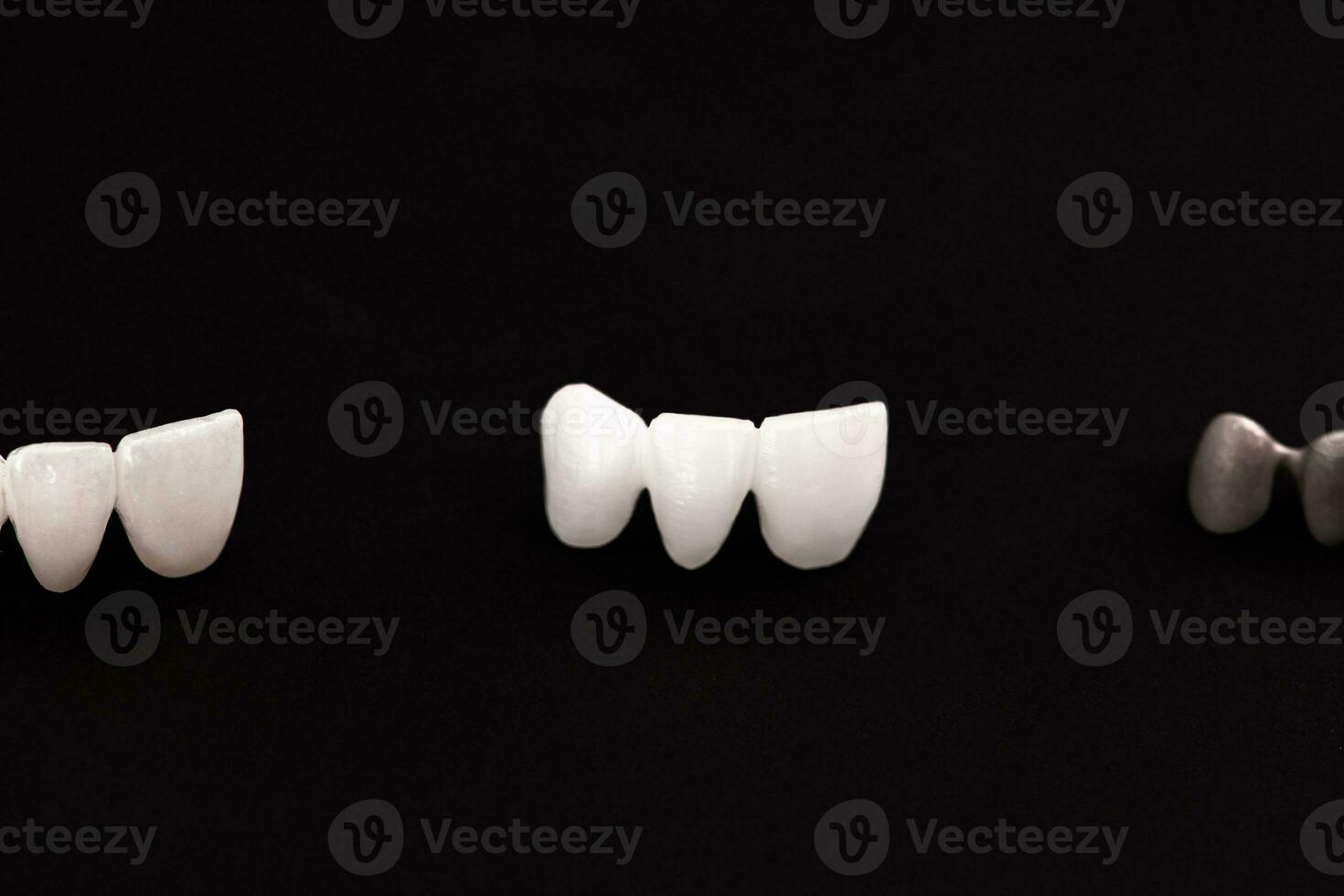 Teeth implant and crown installation process parts isolated on a black background. Medically accurate 3D model. photo