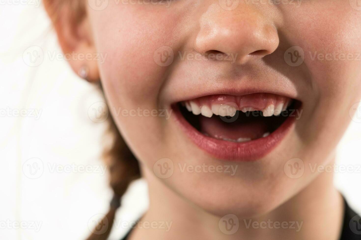 retrato de un pequeño niña en un blanco antecedentes con saludable, desarrollando dientes foto