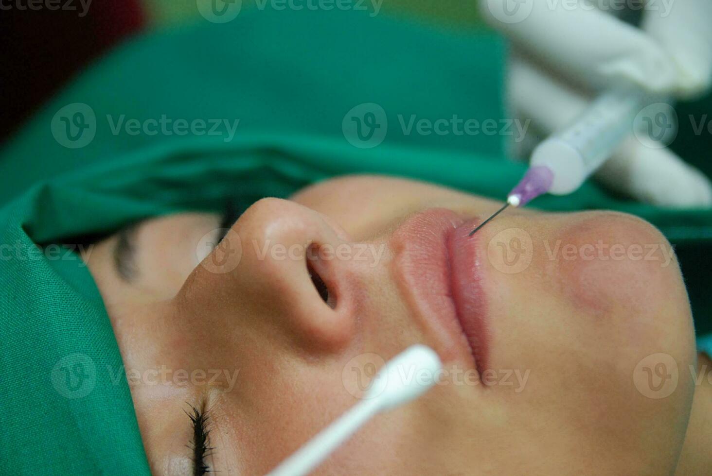 bottox beauty treatment photo