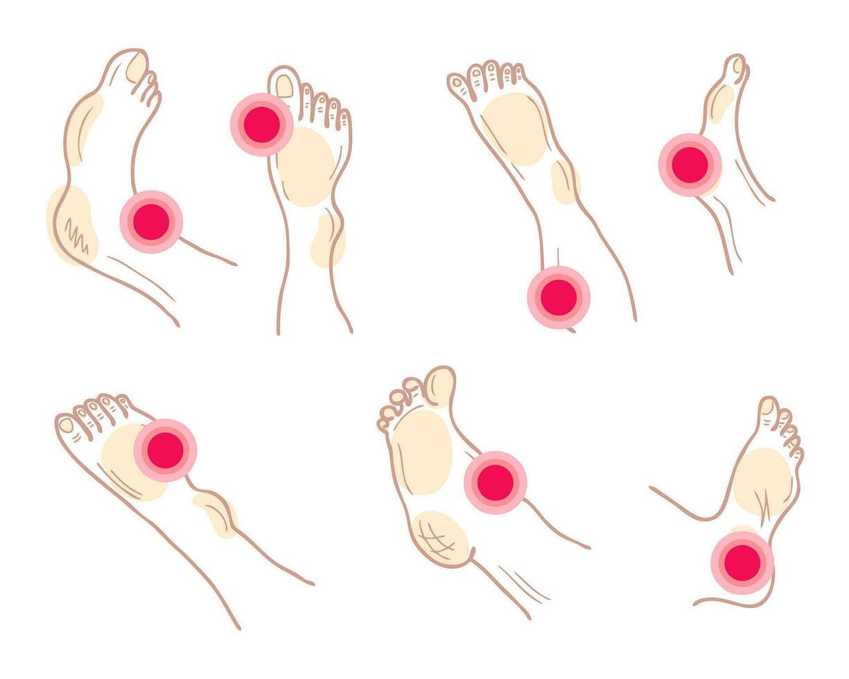 Painful feet and legs with ache mark collection. Muscle pain, medical and medicine concept. vector