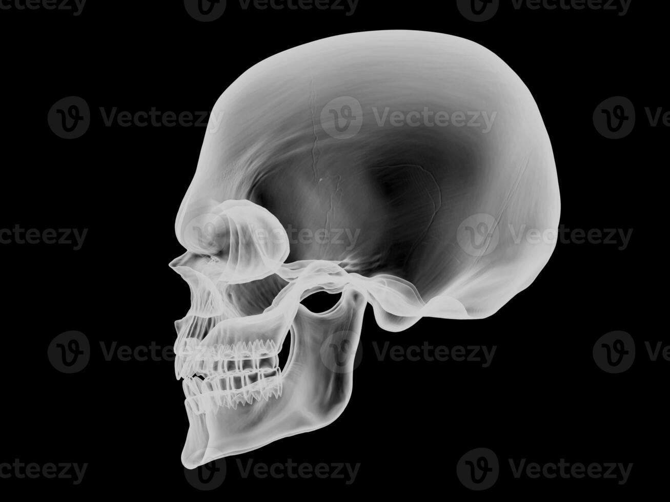 Skull - side view - x ray visual effect photo