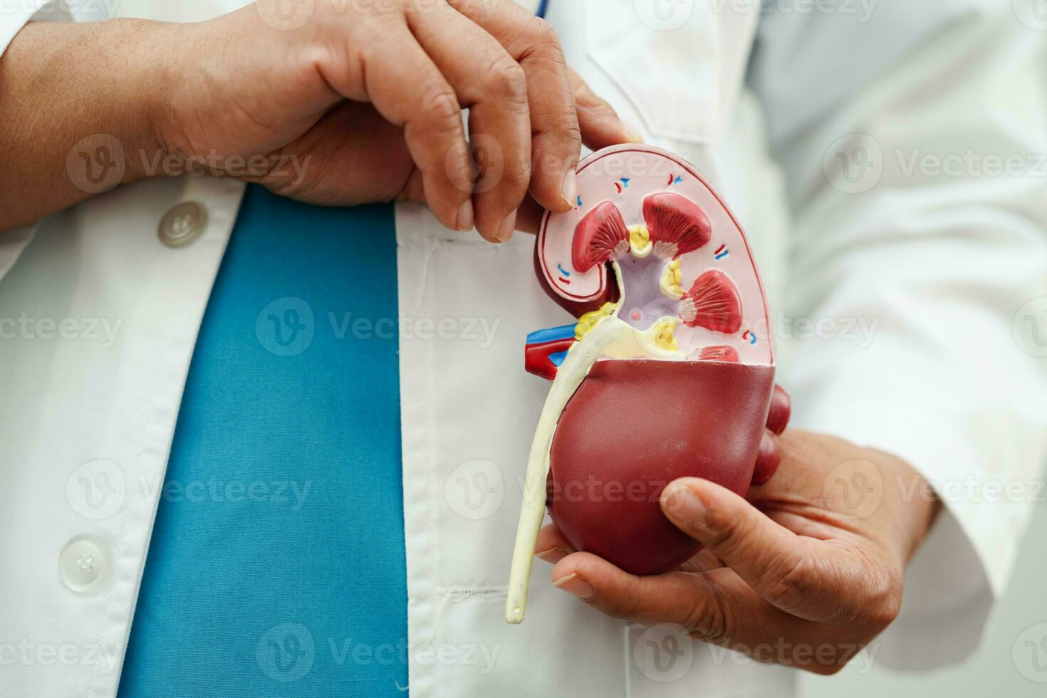 Chronic kidney disease, doctor holding model for treatment urinary system, urology, Estimated glomerular filtration rate eGFR. photo