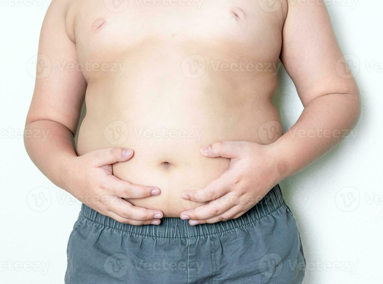 Obese children, overweight, obesity and belly fat photo