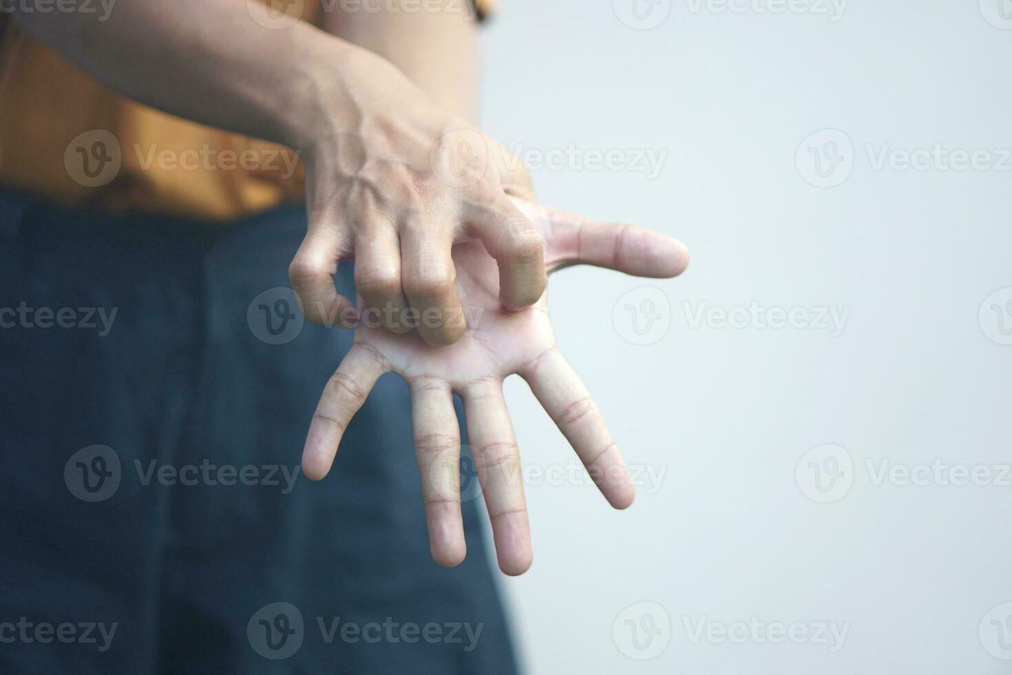 Asian woman having itchy skin on hand photo