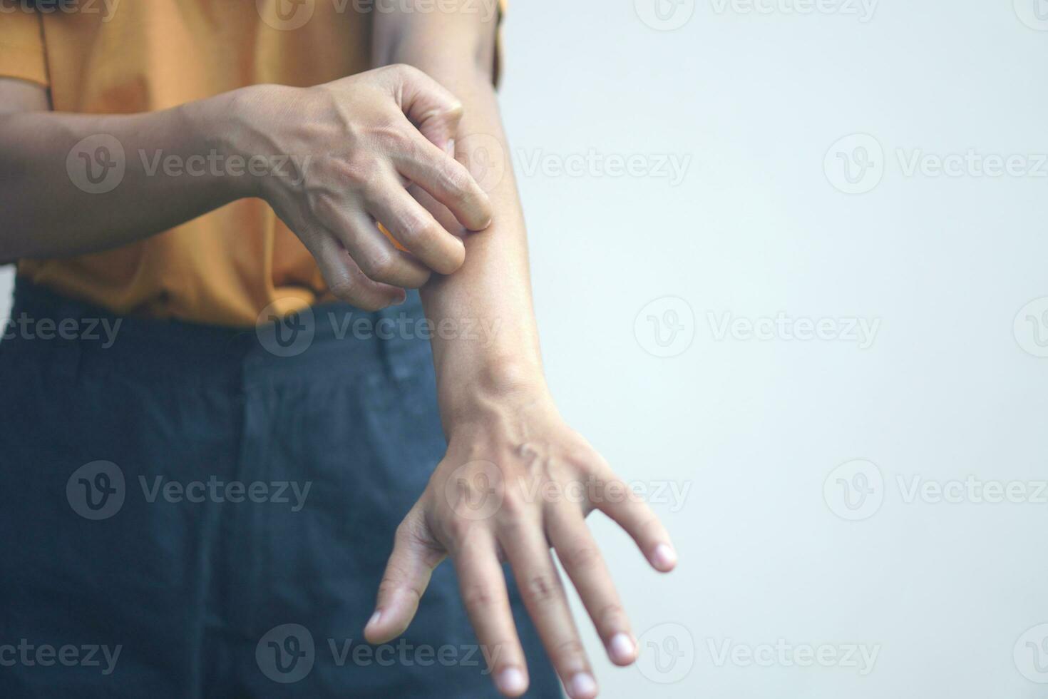 Asian woman having itchy skin on arm. photo
