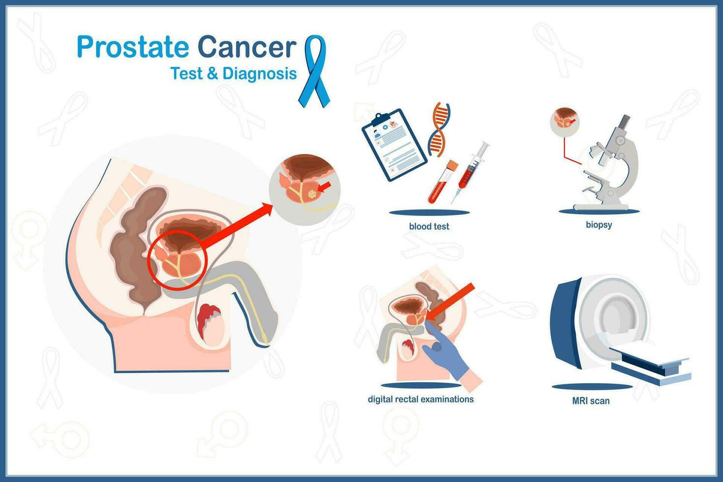 Medical vector illustration in flat style of prostate cancer in prostate cancer analysis and diagnosis concept.blood test,biopsy,MRI scan,digital rectal examination.isolated on white background.