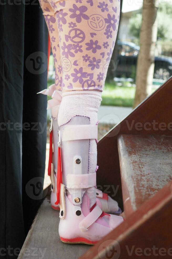 Child cerebral palsy disability, legs orthosis. photo