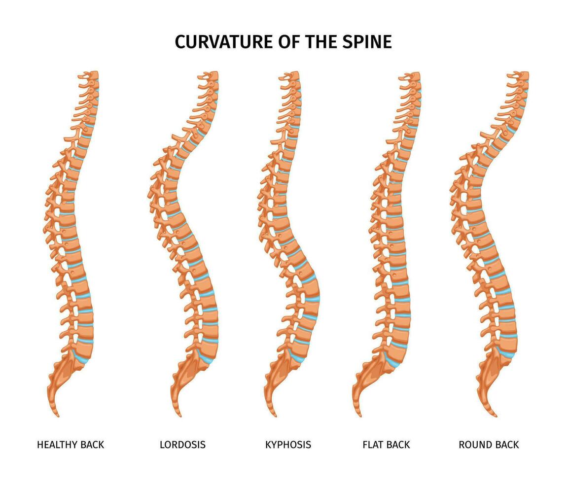 Spine Curvature Anatomy Set vector