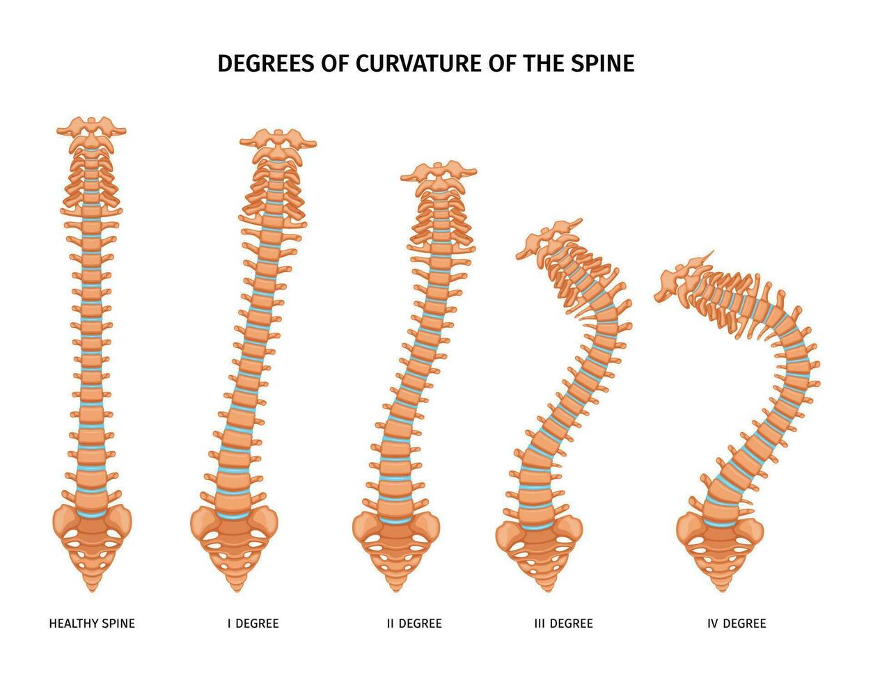 Spine Curvature Degrees Set vector