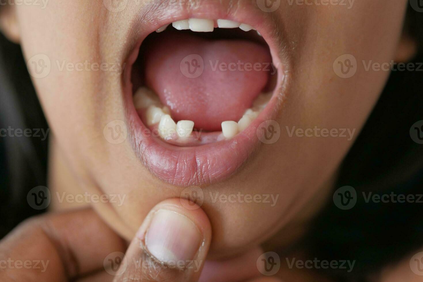 detail shot of child with teeth missing photo