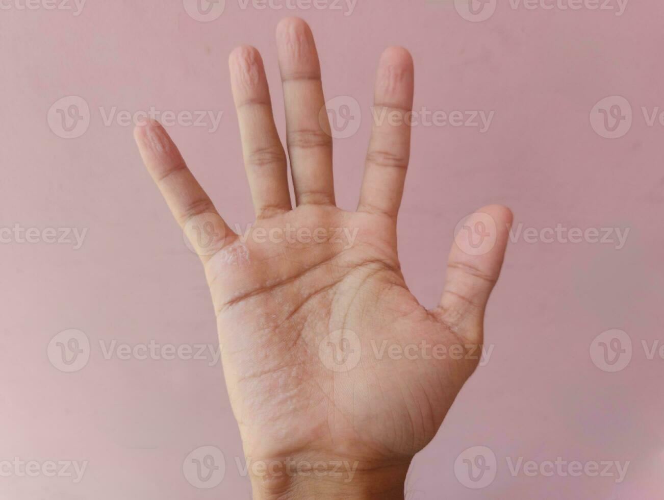 Wrinkly Hands After Swimming. Fingers get so wrinkly after bathing photo