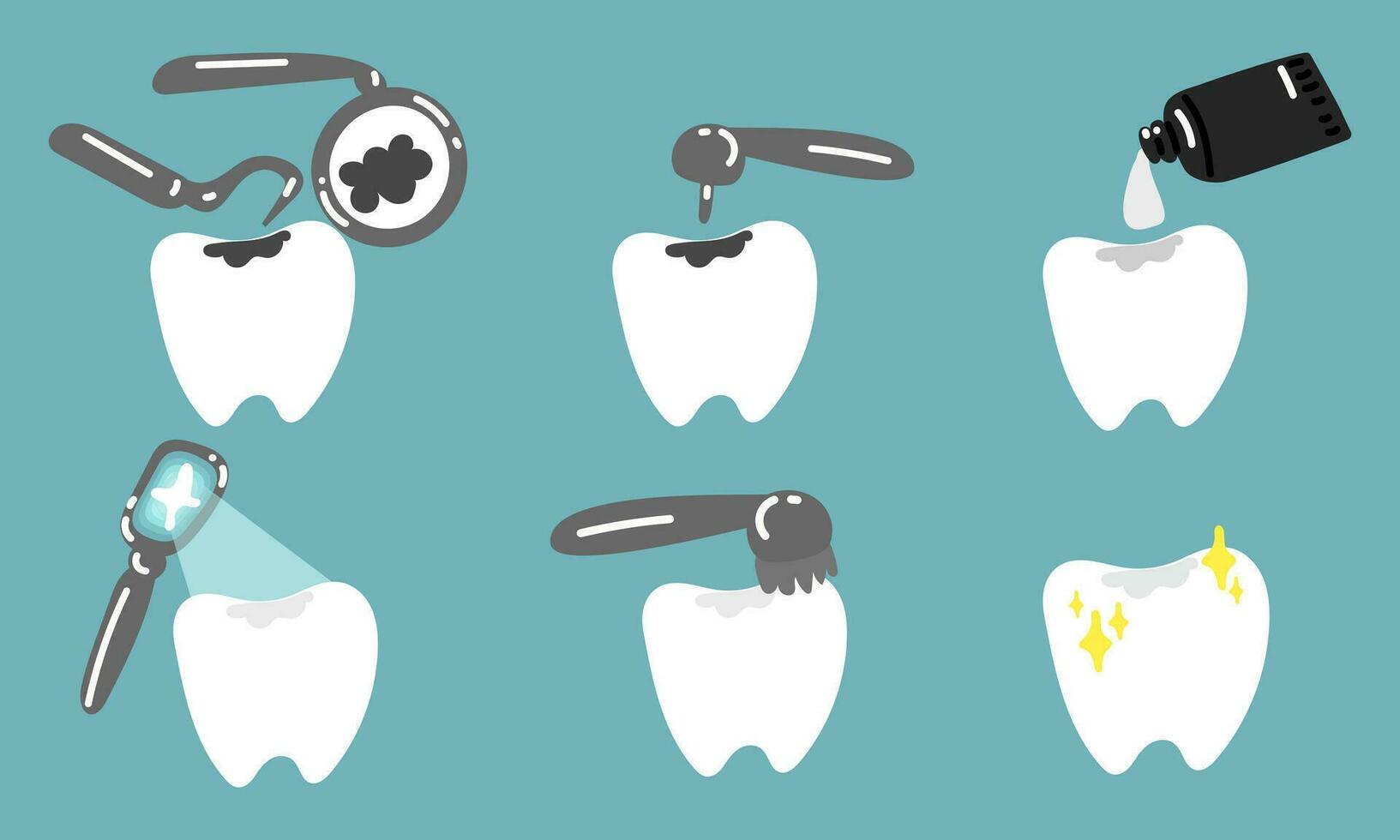 An isolated set of teeth. The process of caries removal and filling. Treatment in dentistry. Dentist appointment. Vector flat illustration on a blue background. All stages of the process