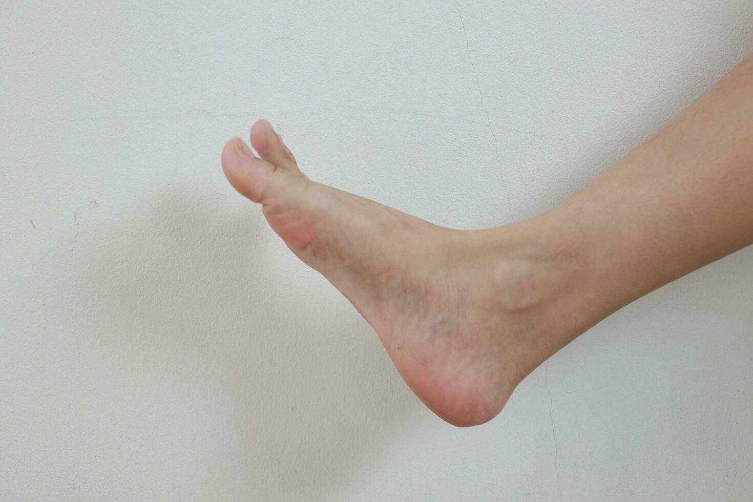 Leg on white background photo