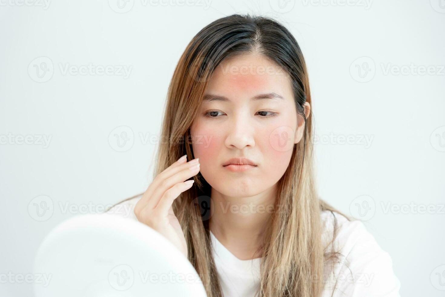 Young woman asian are worried about faces Dermatology and allergic to