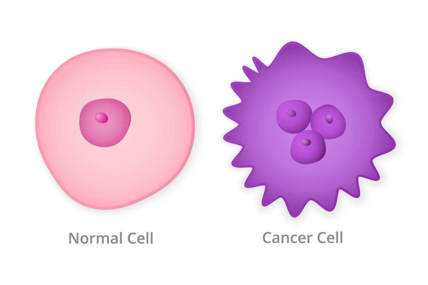 Normal and cancer cell. Healthy pink natural form and metastasized purple with numerous carcinomas oncological growths and tumor vector divisions.