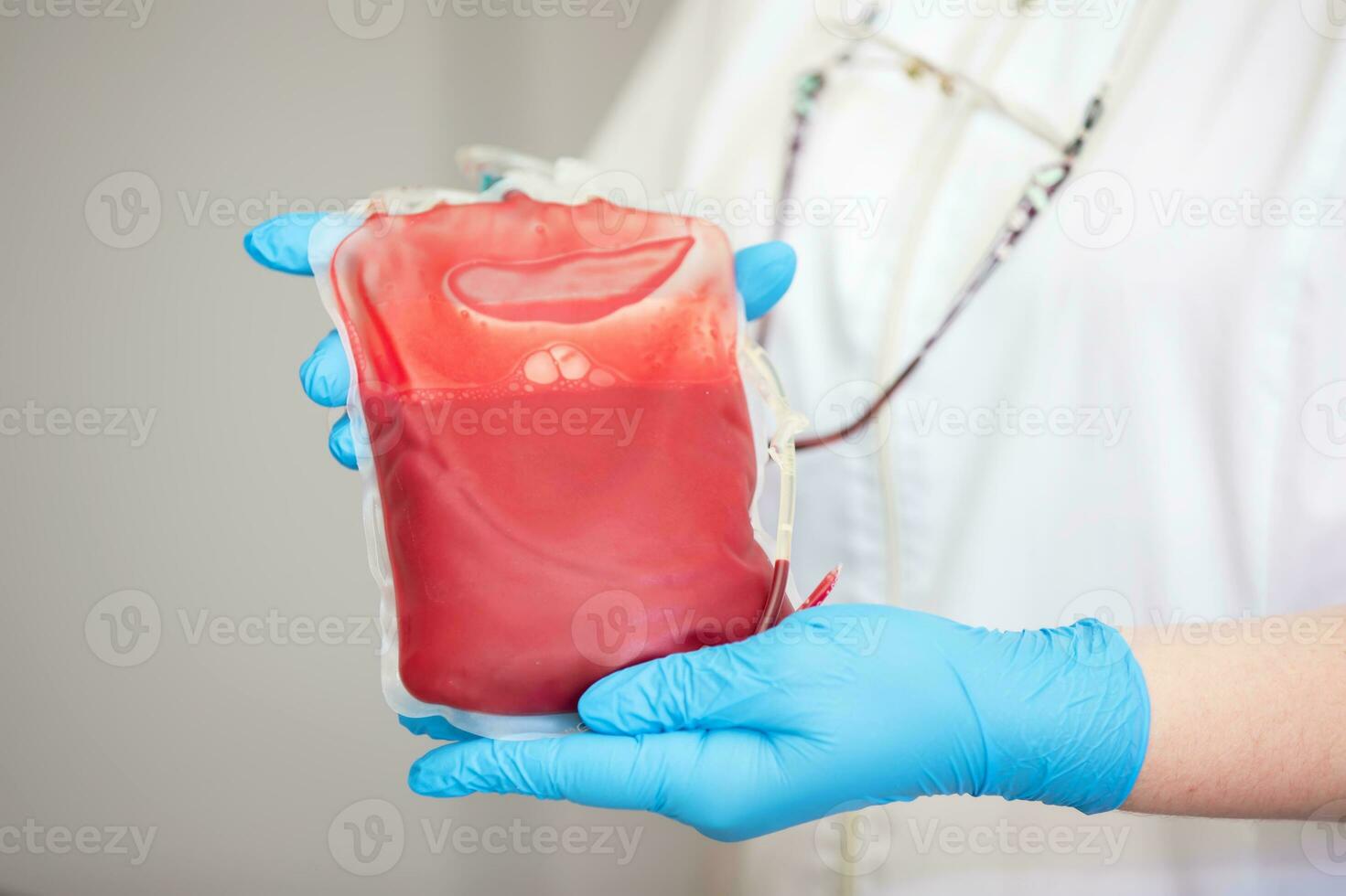 Blood plasma in the center of transfusiology and donation. close up the blood bag in the laboratory in the hands. photo