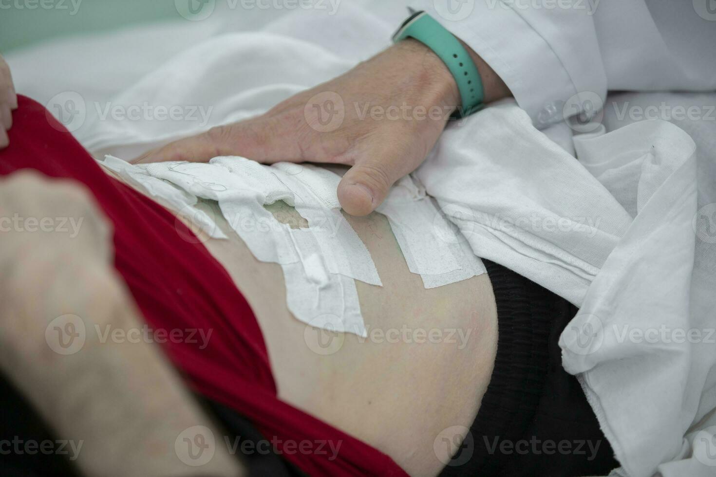 del doctor mano barriga parche.costura sellado con vendajes después cirugía. foto