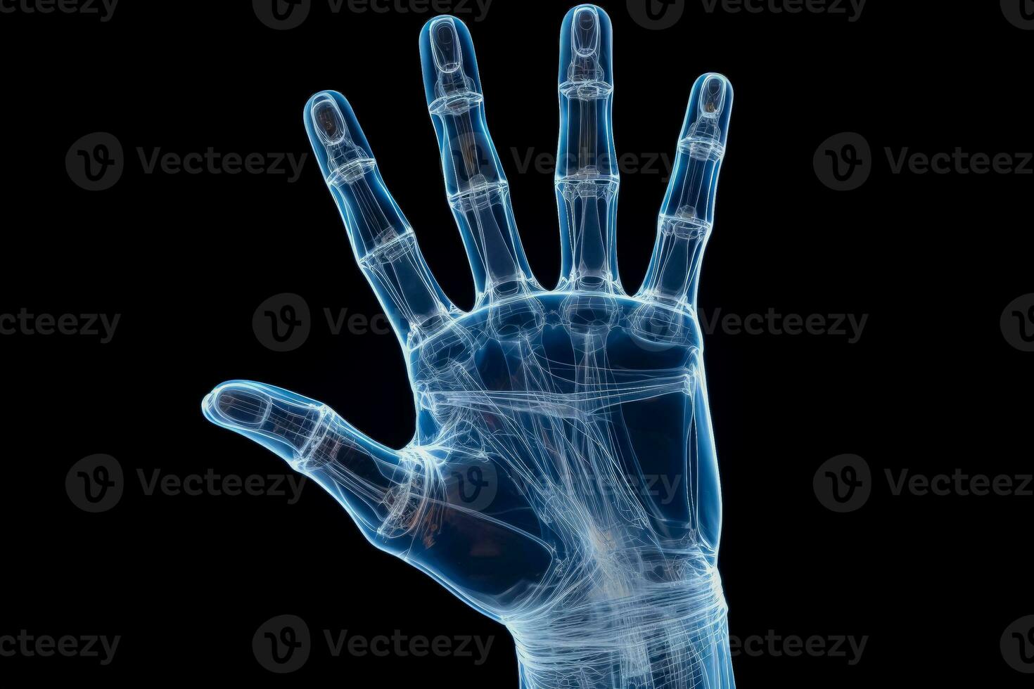 Clear X ray image illustrating a human hand joint and bone structure photo