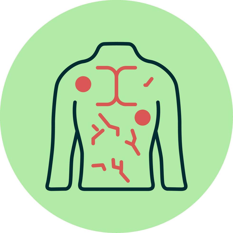 Hives Vector Icon
