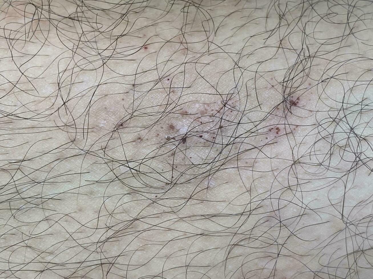 close up wound on skin photo