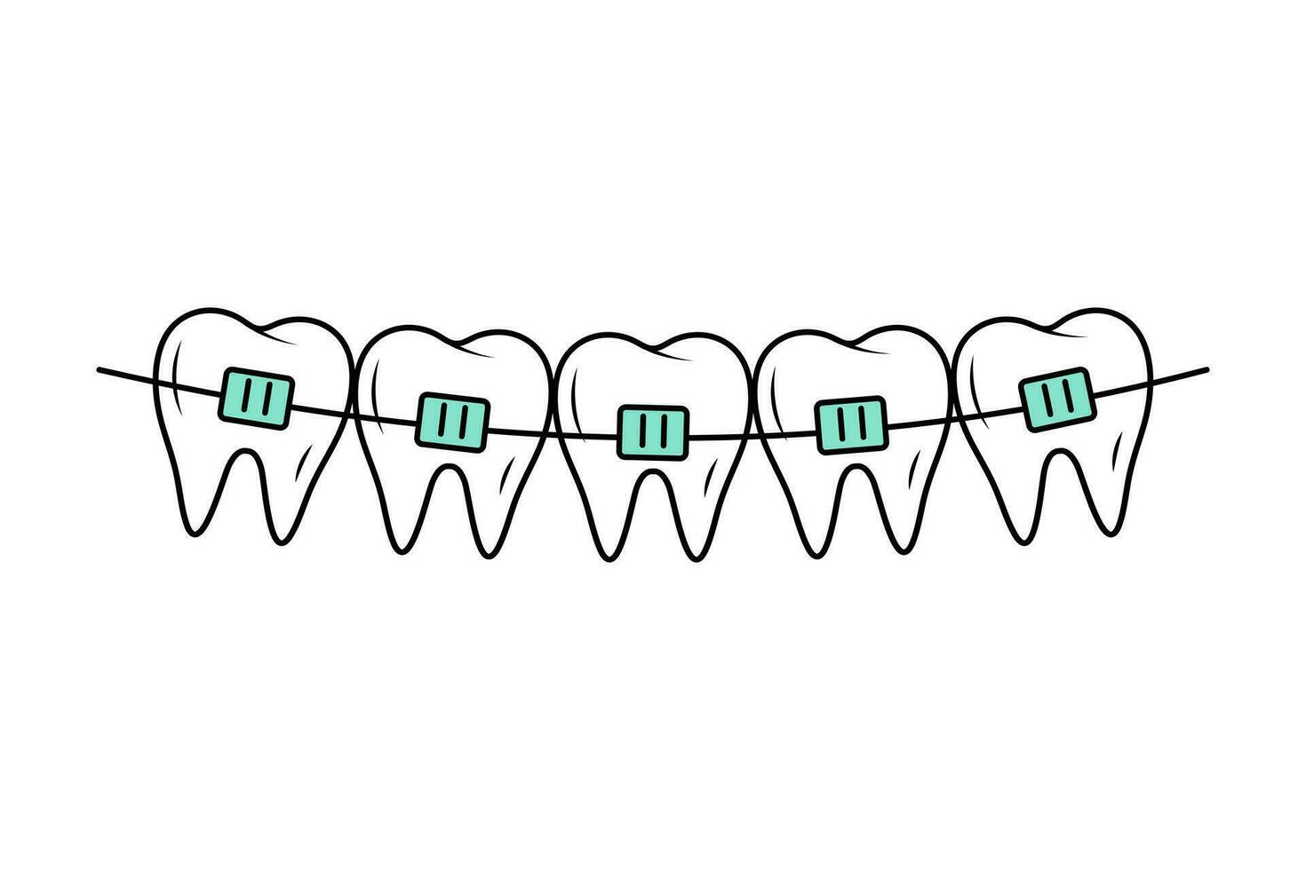 dientes con tirantes en garabatear estilo. correctivo ortodoncia. dental cuidado. lineal vector ilustración.