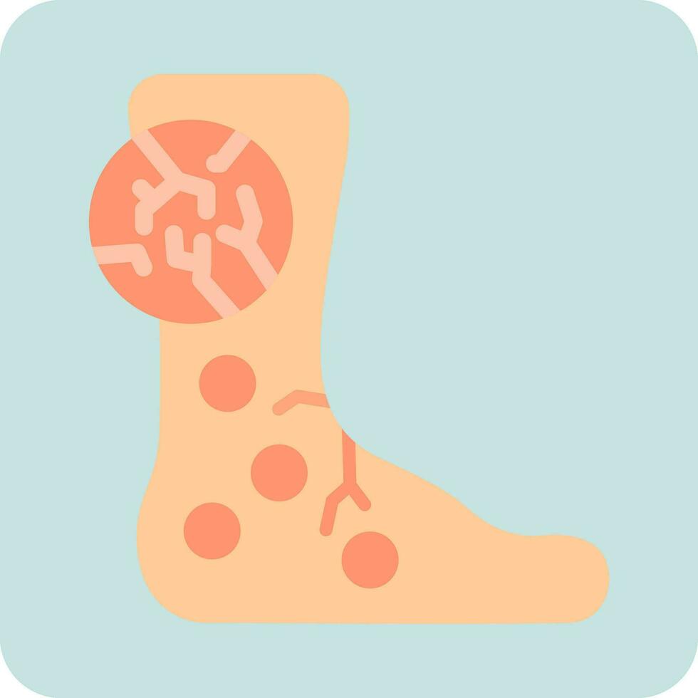 Hives Vector Icon