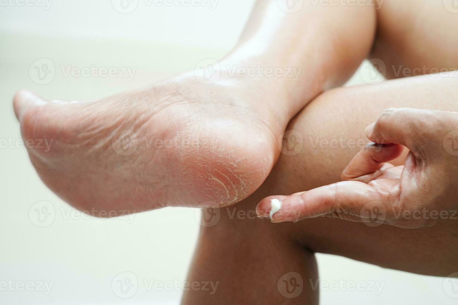 asiático mujer aplicando hidratante crema protección de la piel tratamiento a resolver y reparar pies con grieta y seco tacón piel. foto
