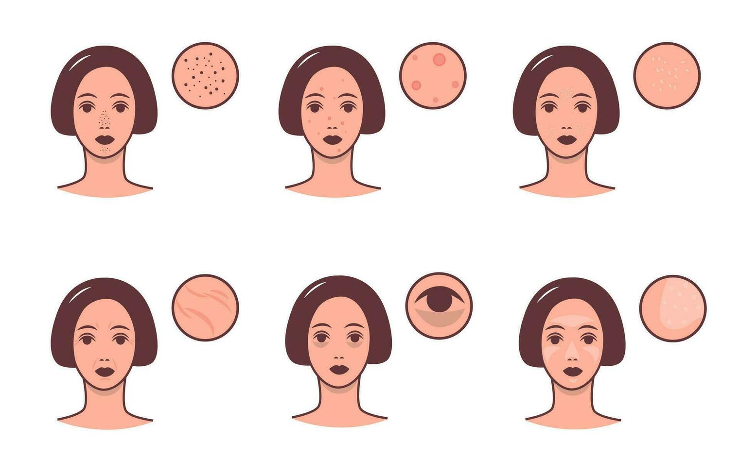 conjunto de hembra caras con varios piel condiciones y problema. protección de la piel y dermatología concepto. vector vistoso ilustración.