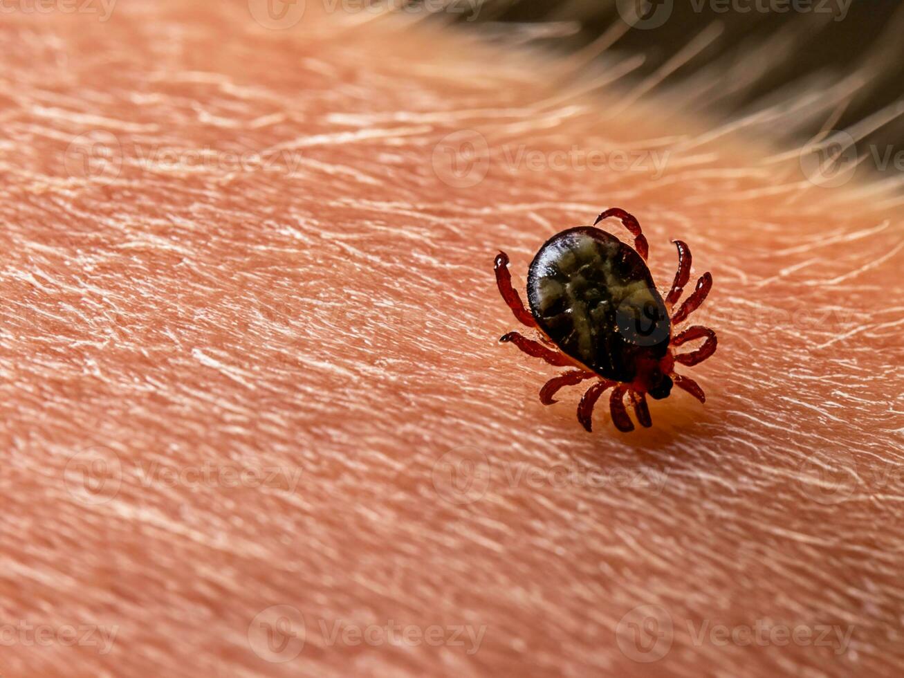 close up of red tick with blood. macro shot of human hand with tick. photo