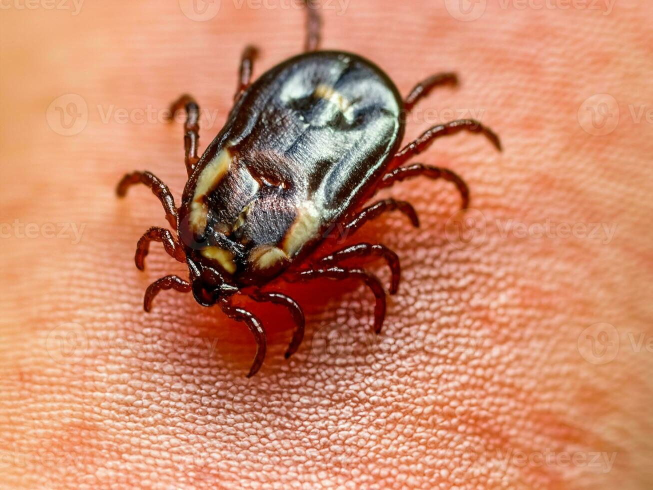 close up of red tick with blood. macro shot of human hand with tick. photo