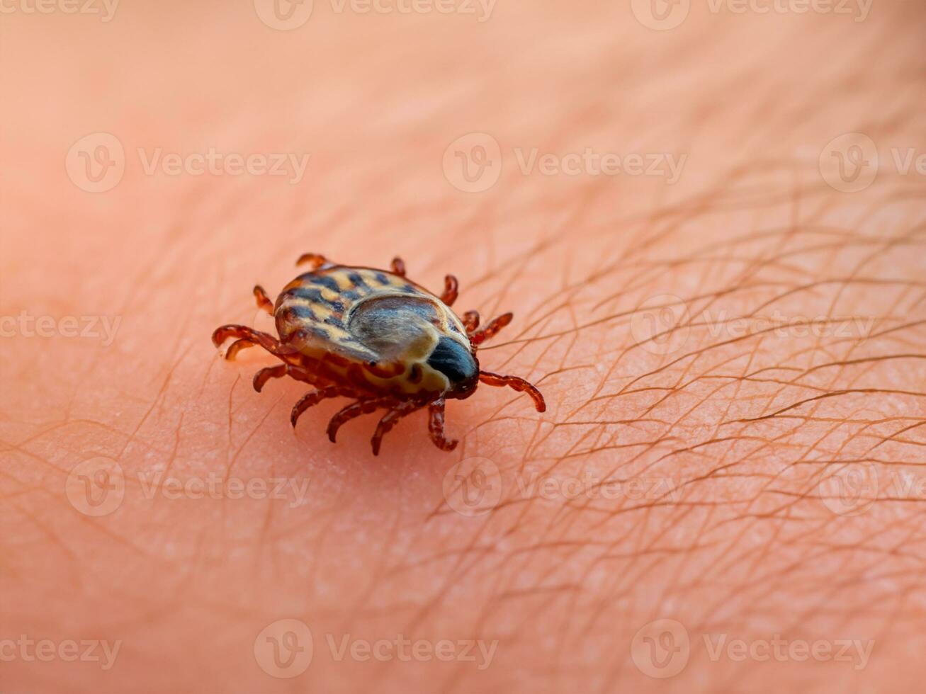 close up of red tick with blood. macro shot of human hand with tick. photo