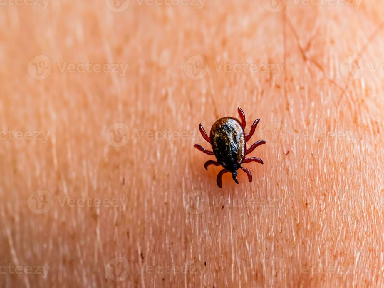 close up of red tick with blood. macro shot of human hand with tick. photo