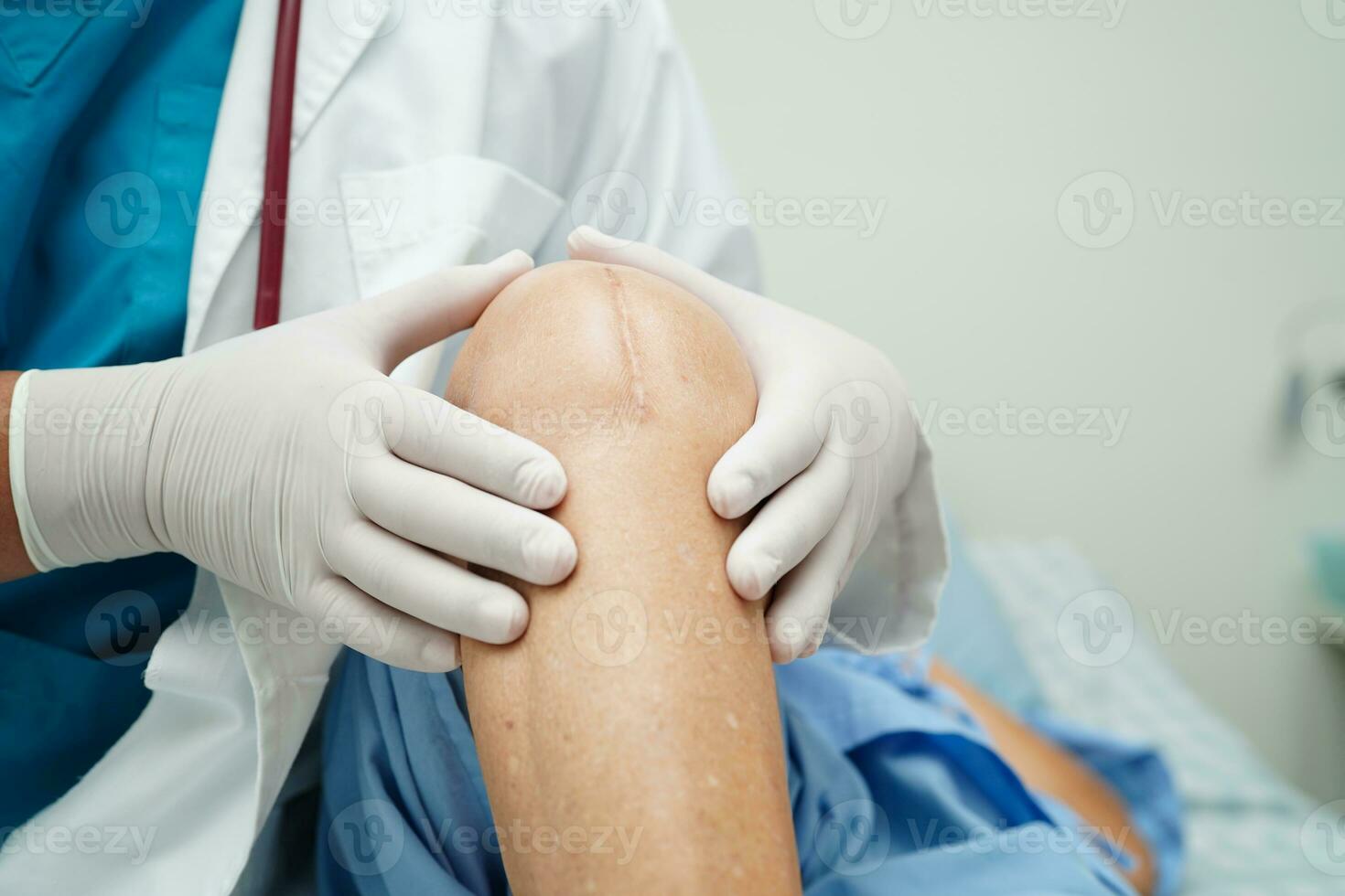 Doctor checking Asian elderly woman patient with scar knee replacement surgery in hospital. photo