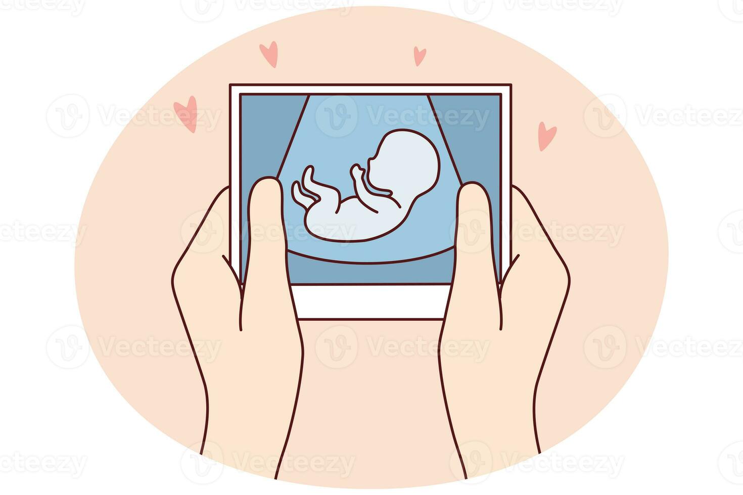 Future mother hold scan of embryo photo