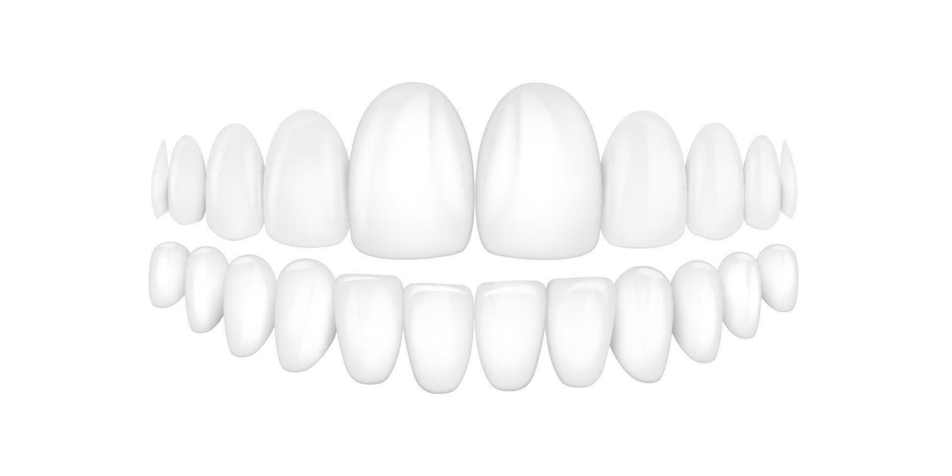 Vector 3d Realistic Render White Denture Set Closeup Isolated. Dentistry and Orthodontics Design. Human Teeth for Medical and Toothpaste Concept.