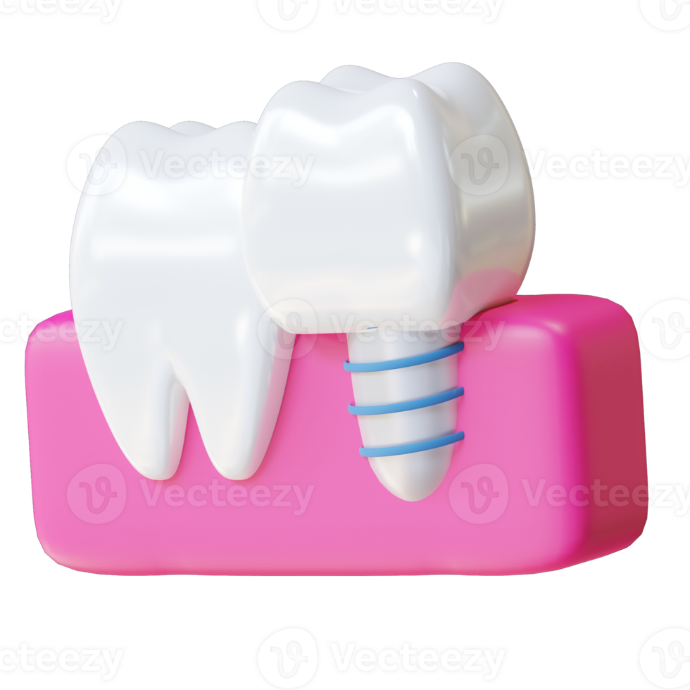 3d illustration dental implant png