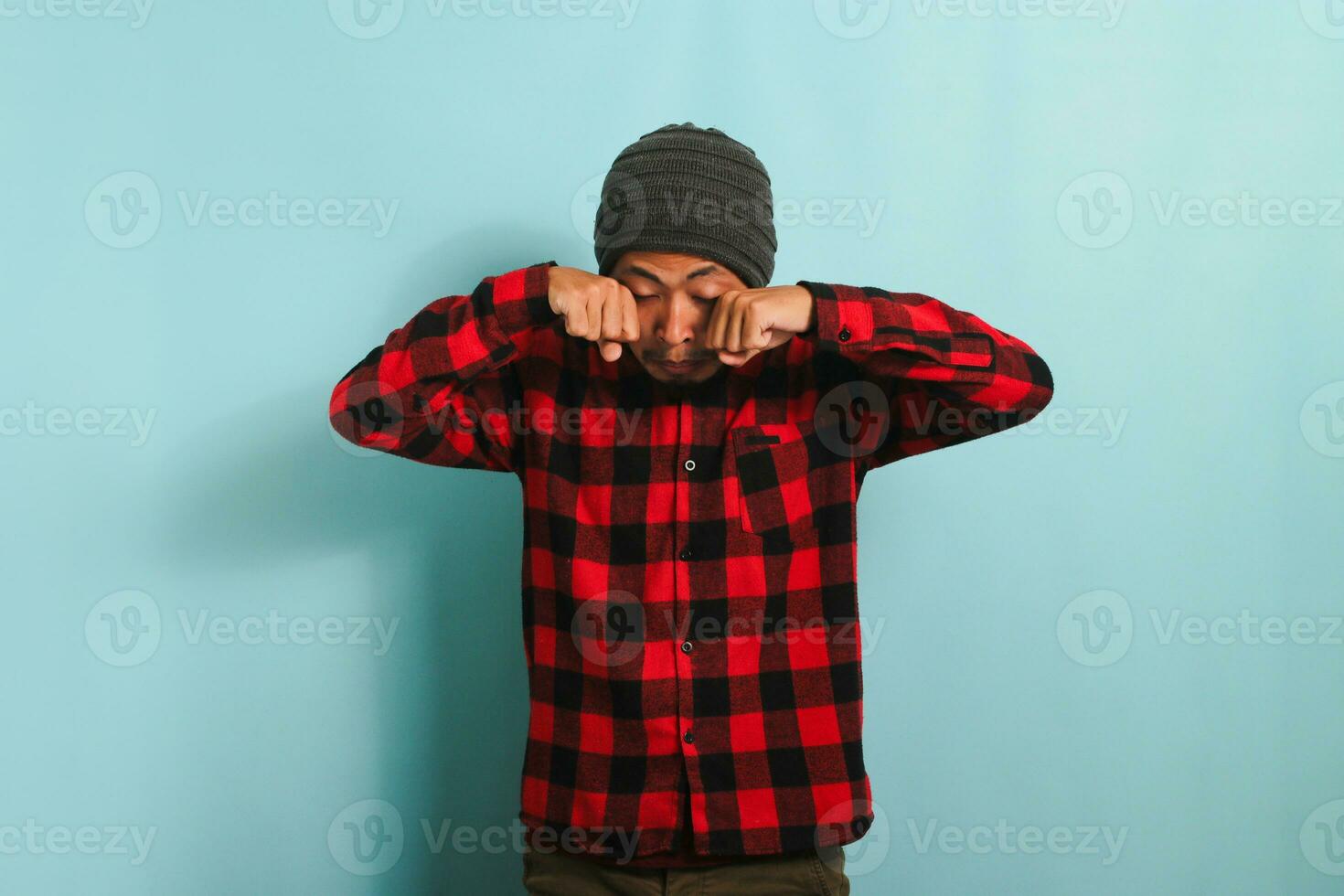 Young Asian man rubbing his swollen eyes due to dust allergy and