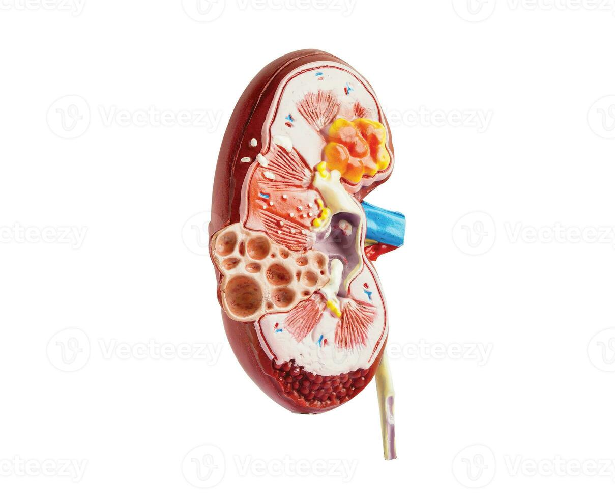 riñón modelo aislado en blanco antecedentes con recorte camino. crónico riñón enfermedad, tratamiento urinario sistema, urología, estimado glomerular filtración Velocidad egfr. foto