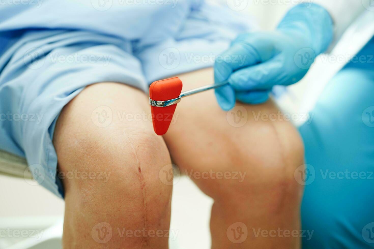 Asian doctor knock on knee reflex nerve for check and treatment senior patient in hospital. photo