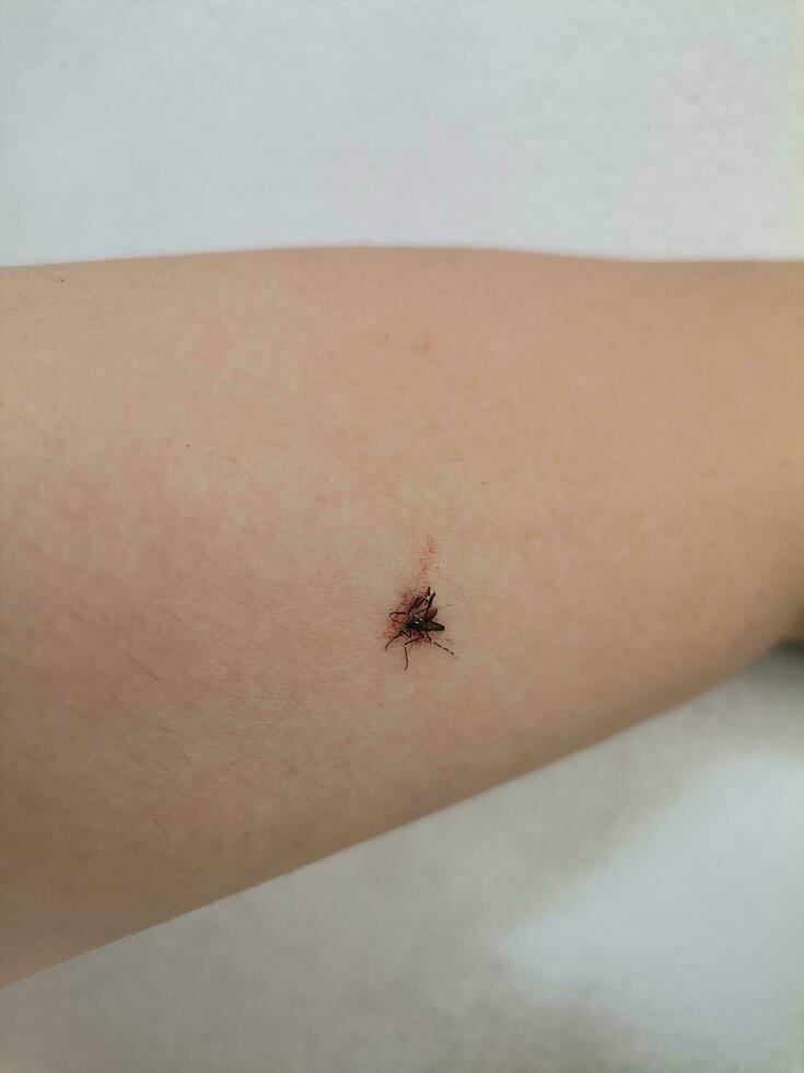 mosquito obtiene abofeteado y muere en el brazo Aedes mosquitos son portadores de dengue fiebre. foto