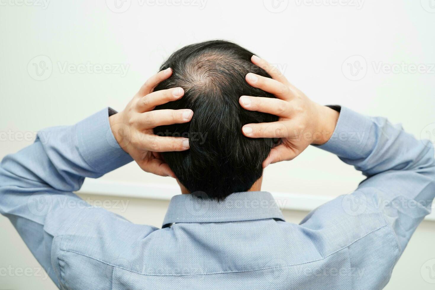 Bald head in man, hair loss treatment health problem. photo