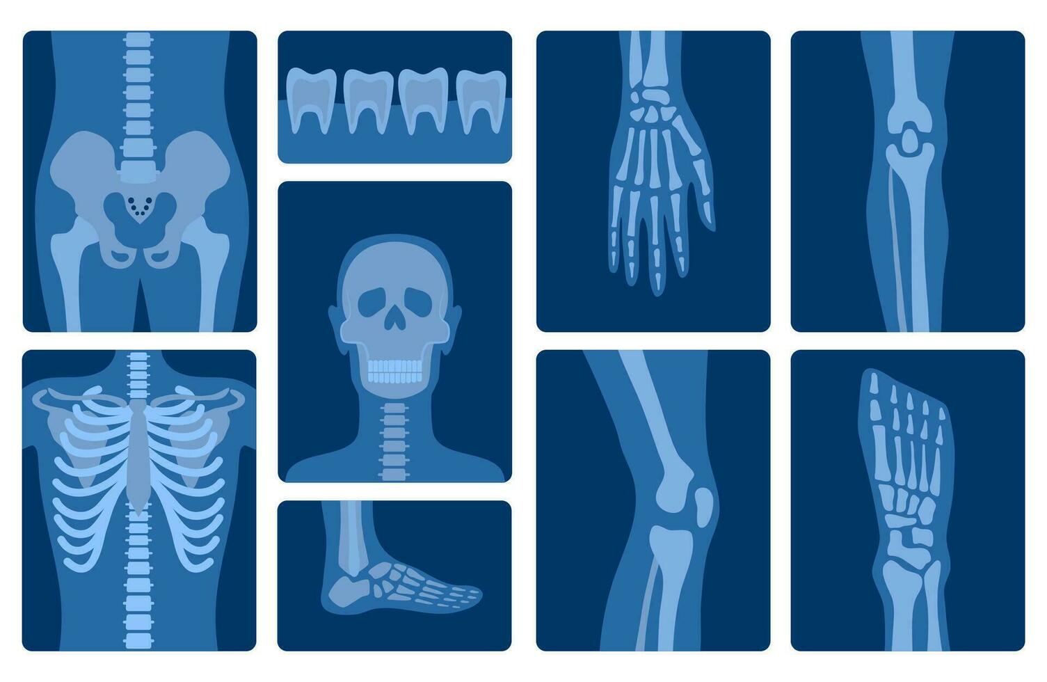 Cartoon Color Xray Shots Human Skeleton Body Parts Set. Vector